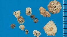 Trockene, braune Samen der Weg-Malve (Malva neglecta) mit auffällig runzeliger Oberfläche auf blauem Hintergrund.