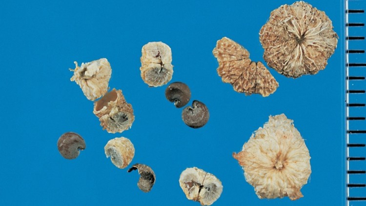 Trockene, braune Samen der Weg-Malve (Malva neglecta) mit auffällig runzeliger Oberfläche auf blauem Hintergrund.